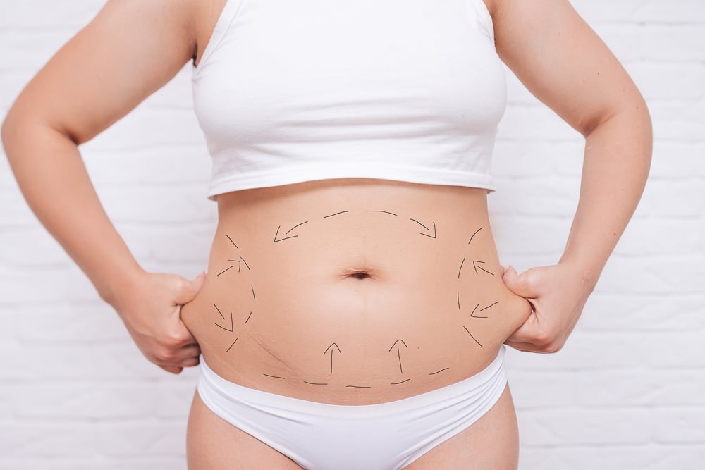 Body Contouring: How to Ensure Long-Lasting Results | Re-Nu Aesthetics